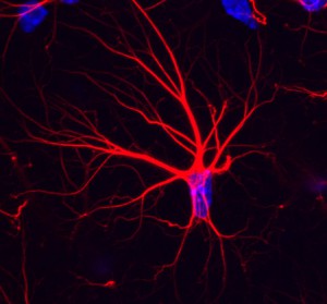 multiple_astrocyte-dapi